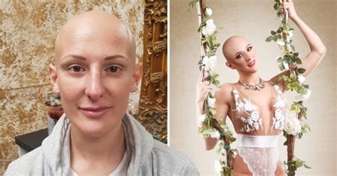 Women With Alopecia Pose In Stunning Photo Series To Show That Bald Is