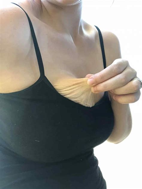 How To Prevent Breast Sagging Causes And Tips Wearavo