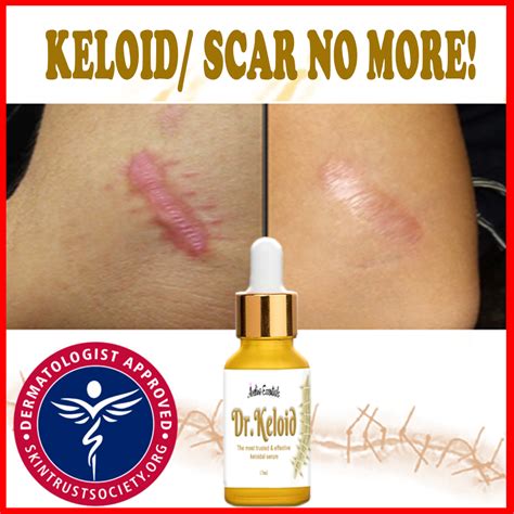 Dr Keloid Scar And Keloid Remover Serum Keloids Remover Scars