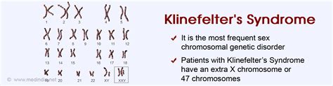 Klinefelters Syndrome Causes Symptoms Diagnosis Treatment And Complications