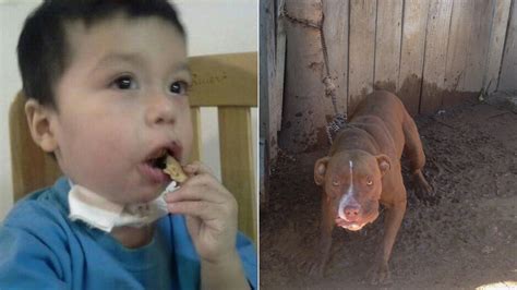 Pit Bull Attacks 1 Year Old Boy In Jurupa Valley Abc7 Los Angeles