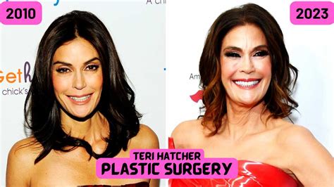 Teri Hatcher S Plastic Surgery Confirmed Or Just Another Rumor
