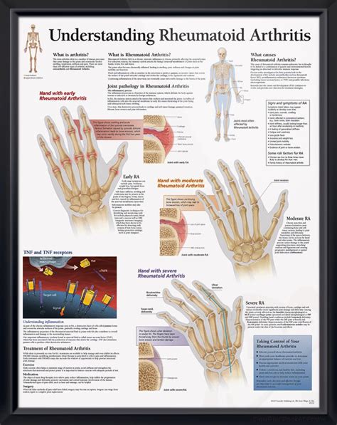 Pin On Doctors Anatomy Posters