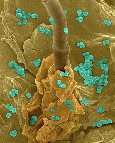 Staphylococcus Aureus On Human Skin Photograph By Dennis Kunkel