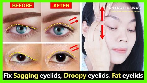 Get Big Eyes View And Natural Double Eyelids Fix Sagging Eyelids