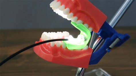 Dental Mouth Prop Bite Block Ascentcare Dental Labs