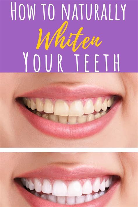 Natural Diy Teeth Whitening Recipes Simple Pure Beauty