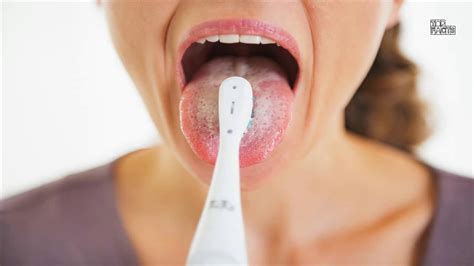 White Tongue What Are Its Causes And The Best Remedies To Treat It