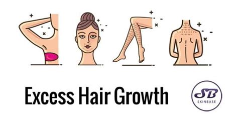 Excess Hair Growth Hirsutism Can We Treat It