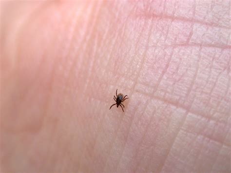 Prevent Tick Bites Things Ticks Won T Tell You Reader S Digest