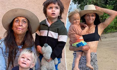 Turia Pitt Reveals How She Honestly Explains Her Injuries To Her Babe Son