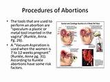 Vacuum Abortion Pictures