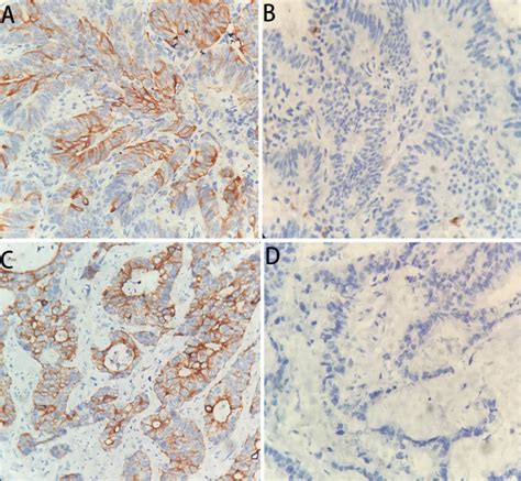 Representative Immunohistochemical Staining Of Pd L1 And Tlr 4 In