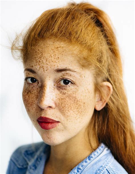 Natasha Culzac Photographed By Michelle Marshall As Part Of The Mc1r Project Beautiful Freckles
