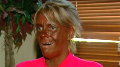 Mom Of 5 Obsessed With Tanning Was Accused Of “burning” Her 6 Year Old