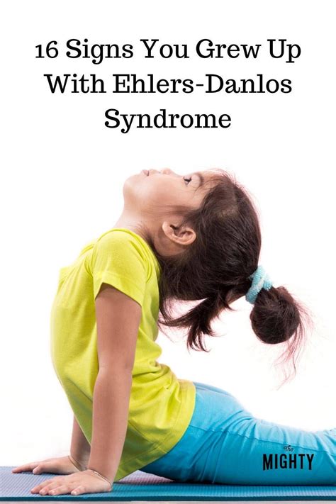 16 Signs You Grew Up With Ehlers Danlos Syndrome Artofit