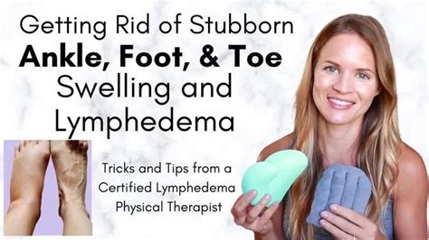 Toe Foot And Ankle Lymphedema And Swelling Tricks To Get Rid Of