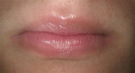My Progress So Far A Long Read At Peeling Lips