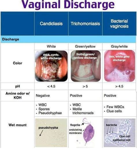Collection Of Female Vaginal Discharge Normal Vaginal Discharges