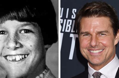 20 Celebs Whose Little Ugly Duckling Transformation Looks Stunning