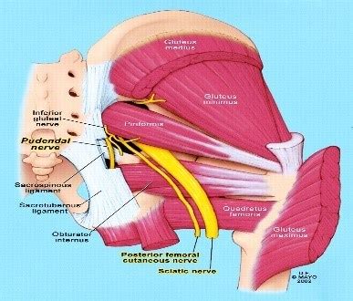 Muscles of the back can be divided into superficial, intermediate, and deep group. Buttock pain, a real pain in the butt? | Physiotherapy Manly