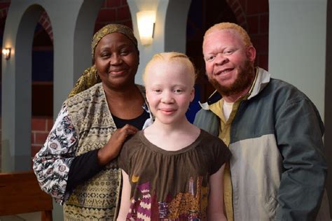 Uzalos New Storyline Tackles Albinism Myths And Killings The Daily Vox