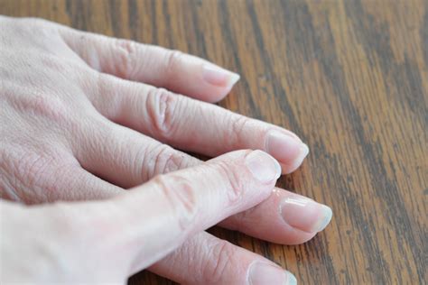 How To Heal A Damaged Cuticle Livestrongcom