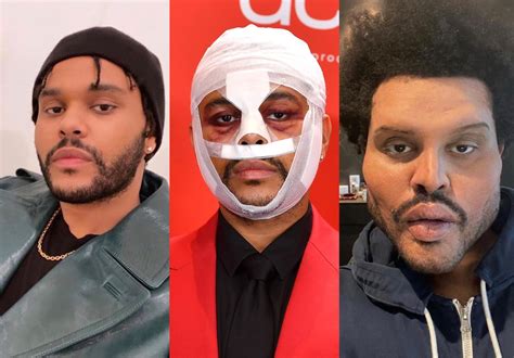 Canadian Singer The Weeknd Shows Off New Grotesque Look In Music Video