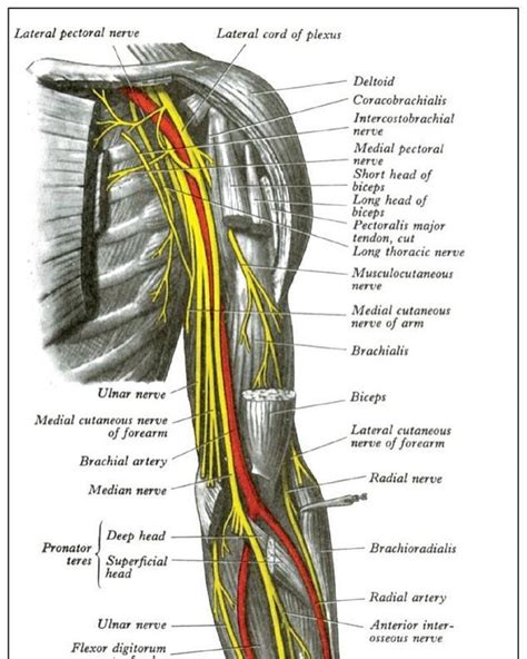 Radial Nerve Dysfunction Radial Nerve Dysfunction Is A Problem With