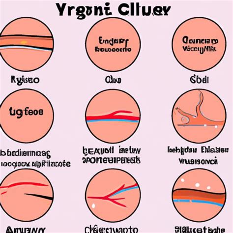 What Is A Skin Ulcer Causes Types Symptoms And Treatment Options The
