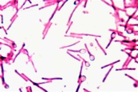 Clostridium Species Anaerobic Spore Forming Gram Positive Rods