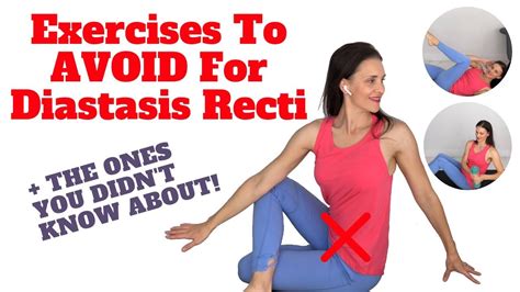 Exercises To Avoid For Diastasis Recti