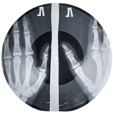 Soviet Era Musical Records Up Cycled From X Rays