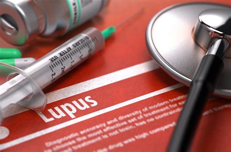 How Can You Treat Lupus Rash Whats Lupus
