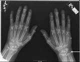 Cleveland Clinic Hand And Wrist