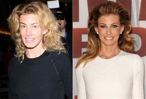 Celebrity Faith Hill Before And After Celeb Surgerycom