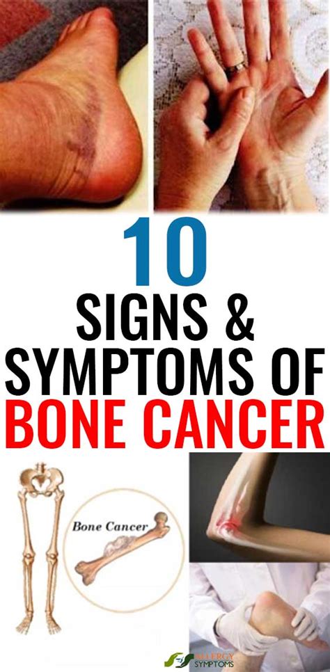 Signs And Symptoms Of Bone Cancer In Knee Cancerwalls