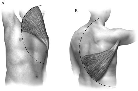 Latissimus Dorsi Muscle Harvest Operative Techniques In Thoracic And