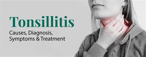 Tonsillitis Causes Diagnosis Symptoms And Treatment