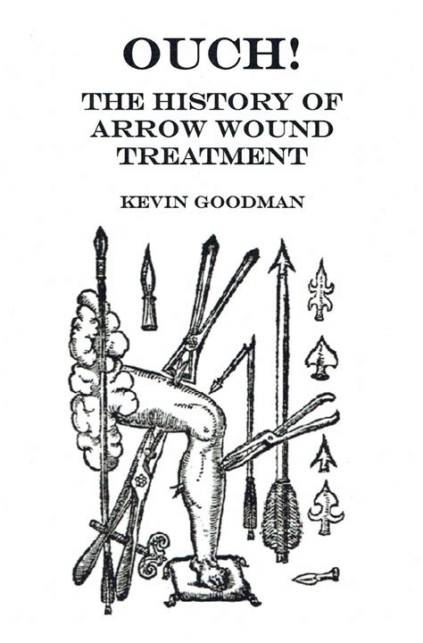 Ouch The History Of Arrow Wound Treatment Signed Copy