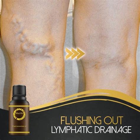 Lymphatic Drainage Ginger Essential Oil Molooco Store
