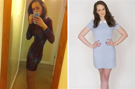 Anorexic Woman Who S Weight Dropped To 4st Makes Amazing Recovery Daily Star