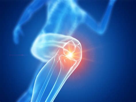 Runners Knee Why You Should Seek Help First Sign Of Knee Pain