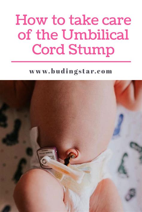 Umbilical Cord Stump Care A Comprehensive Guide Dixon Verse
