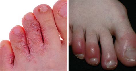 12 Health Warning Signs To Look For In Your Feet