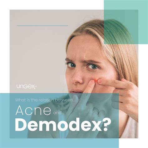What Is The Relation Between Acne And Demodex Mites Demodex Appears