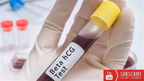 Beta Hcg Test For Pregnancy Youtube