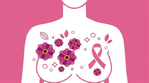 Cada día mueren mujeres por cáncer de mama y el pronóstico es peor