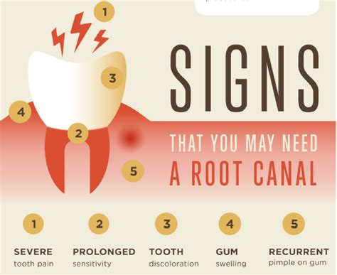 Do i need a root canal or a tooth extraction? Choosing An Endodontist | Finding An Endodontist