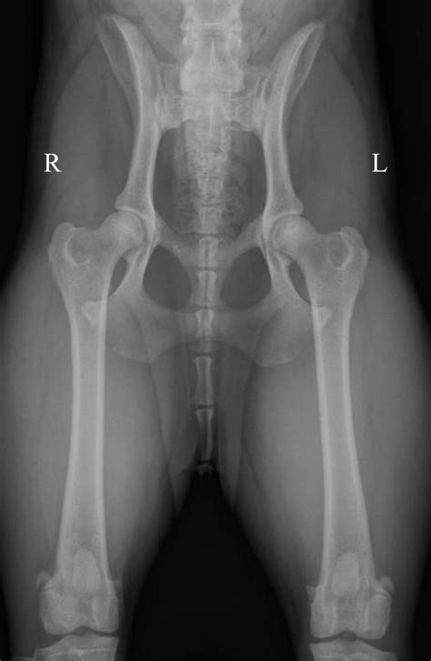 Pelvic Anatomy Xray Interpreting X Rays Of The Pelvis Hip Joint And